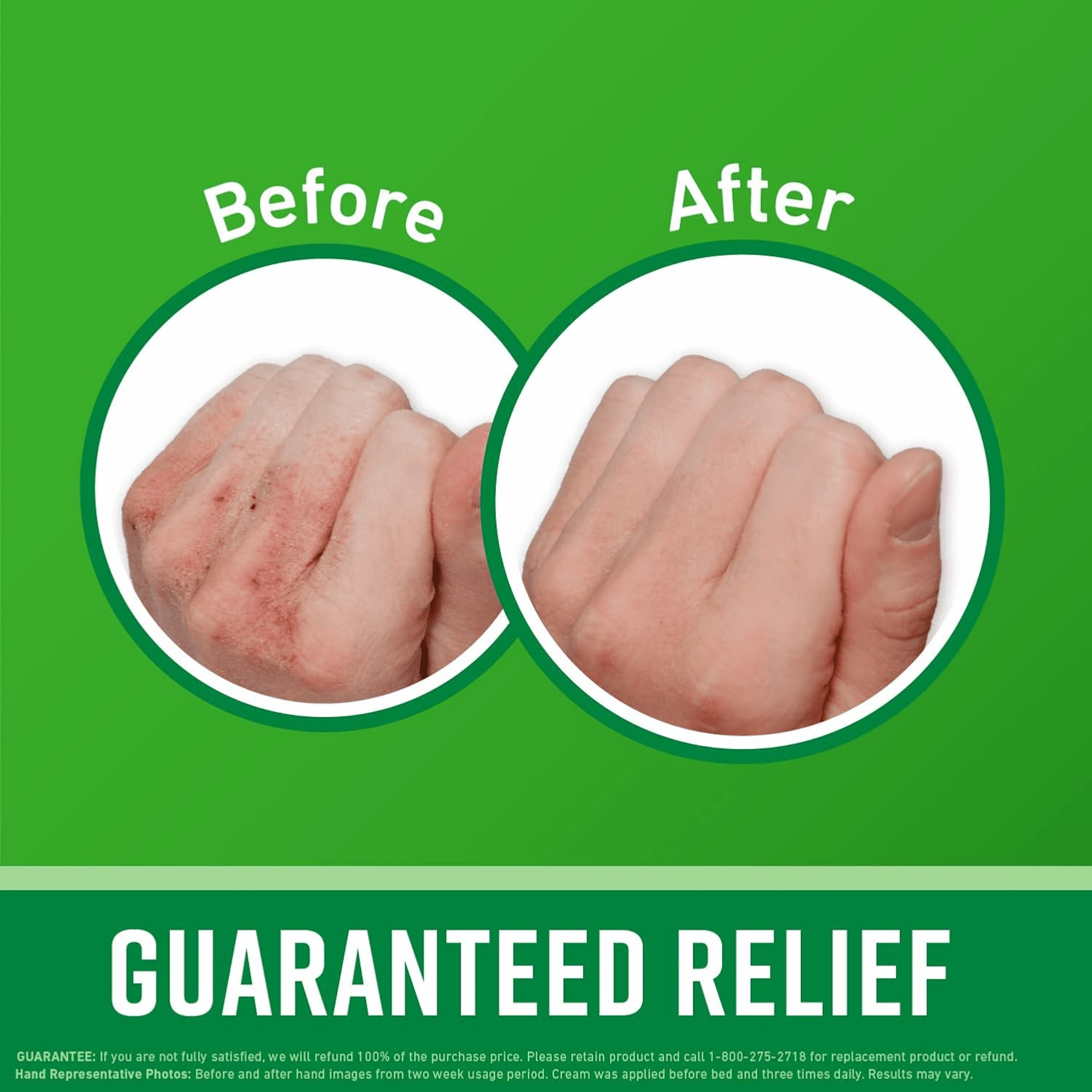 O'KEEFFE'S Working Hands Cream 85g - Relieves Extremely Dry and Cracked Hands
