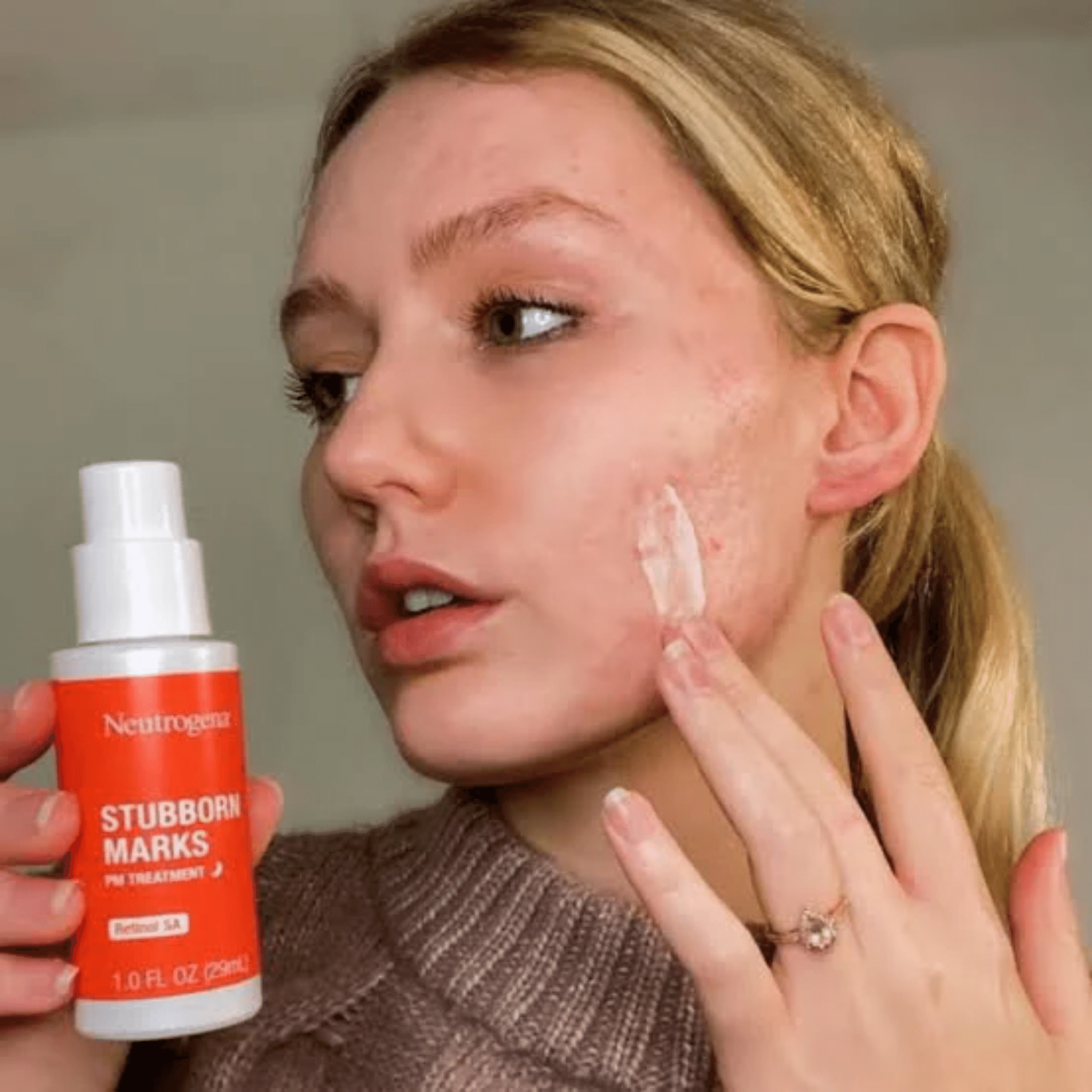 Neutrogena Acne Treatment